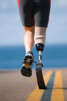 The Next Step: A Prosthetic Patient Peer Program