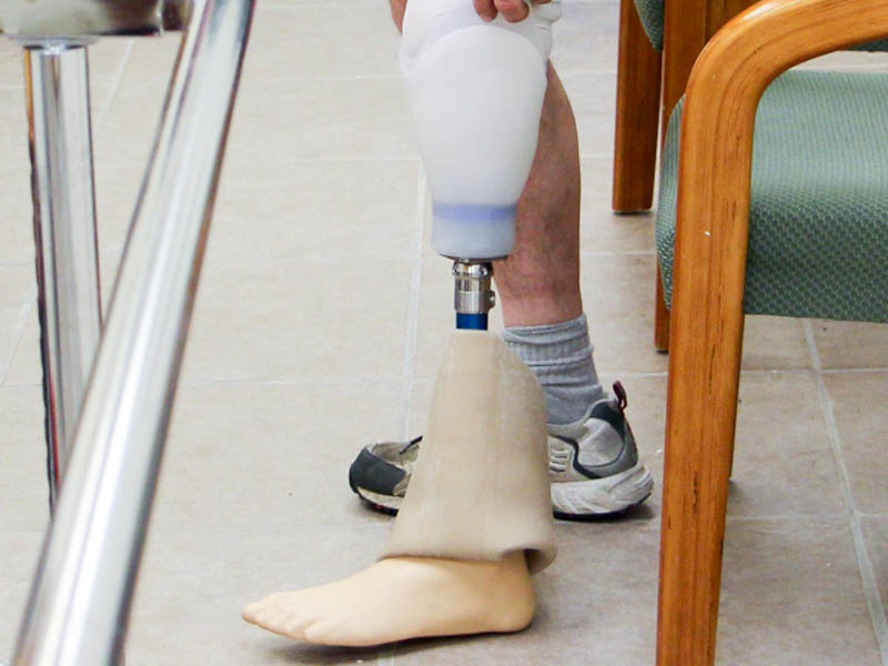 Lower Extremity Prosthetics