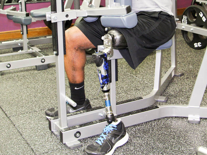 Lower Extremity Prosthetics