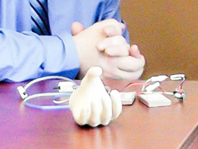 Upper Extremity Prosthetics