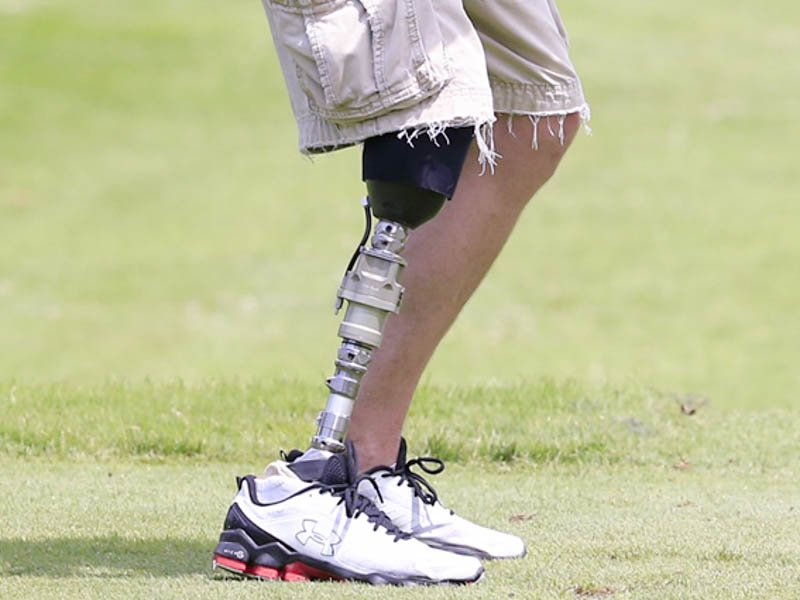 Lower Extremity Prosthetics