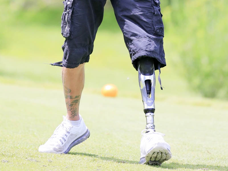 Lower Extremity Prosthetics