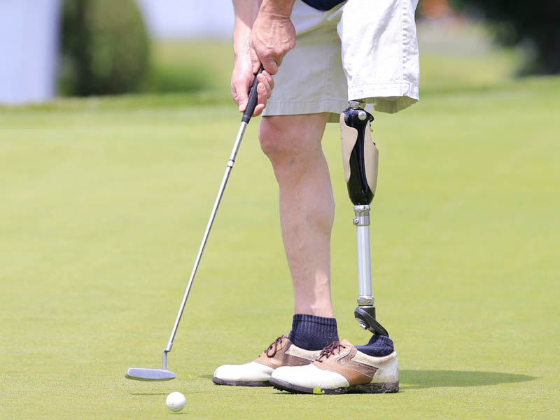 Lower Extremity Prosthetics