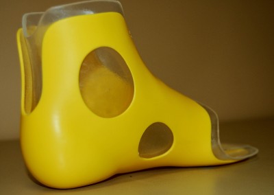 Supra-Malleolar Orthotic (SMO)