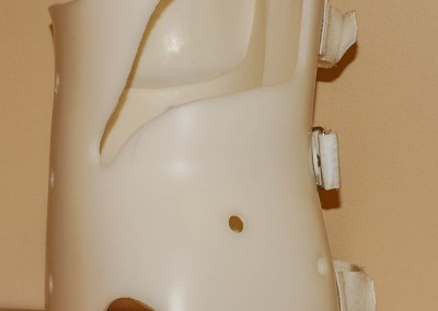 Scoliosis Brace