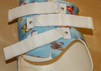 Scoliosis Brace