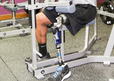 Lower Extremity Prosthetics